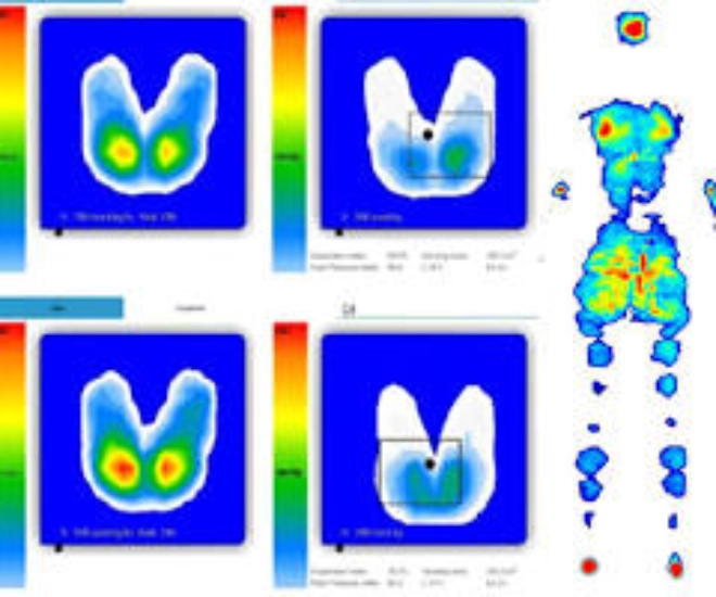 Managing and/or Preventing Pressure Injuries with Wheelchair Users